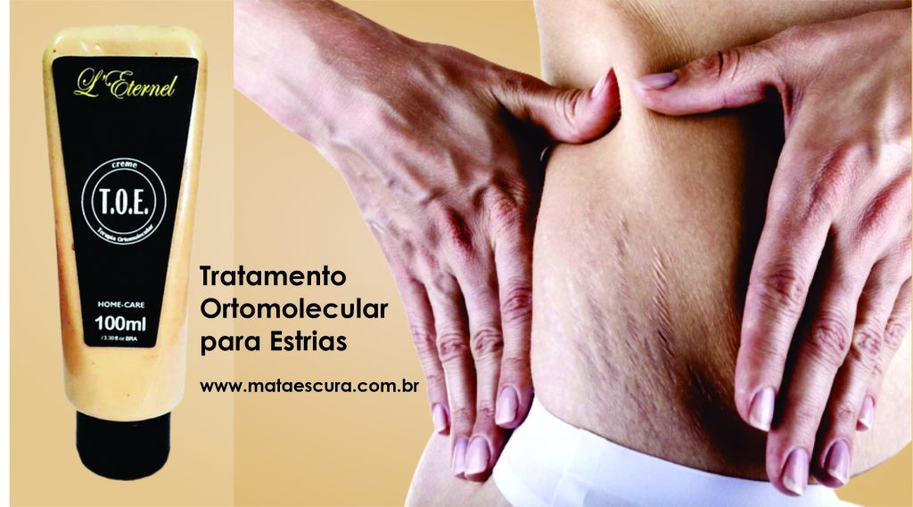 Creme TOE - Tratamento Ortomolecular para Estrias
